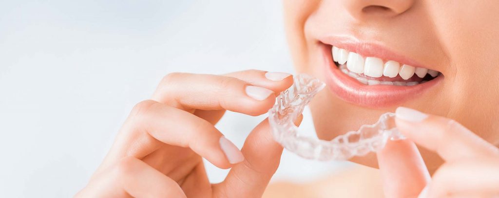 Invisalign clear aligners